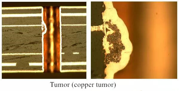 fig3-Tumor (copper tumor)